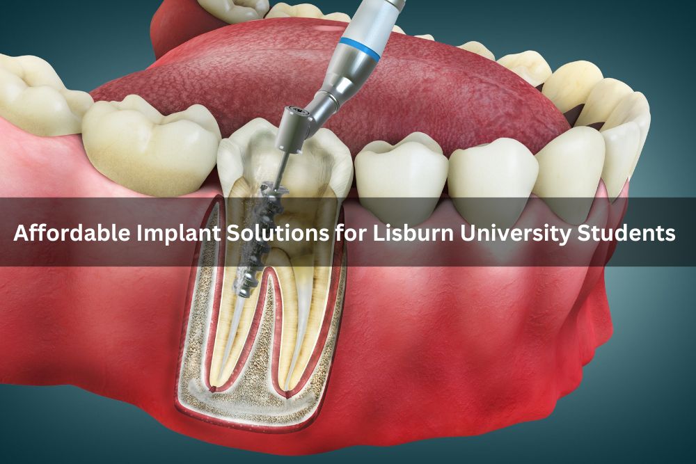 Affordable Implant Solutions for Lisburn University Students