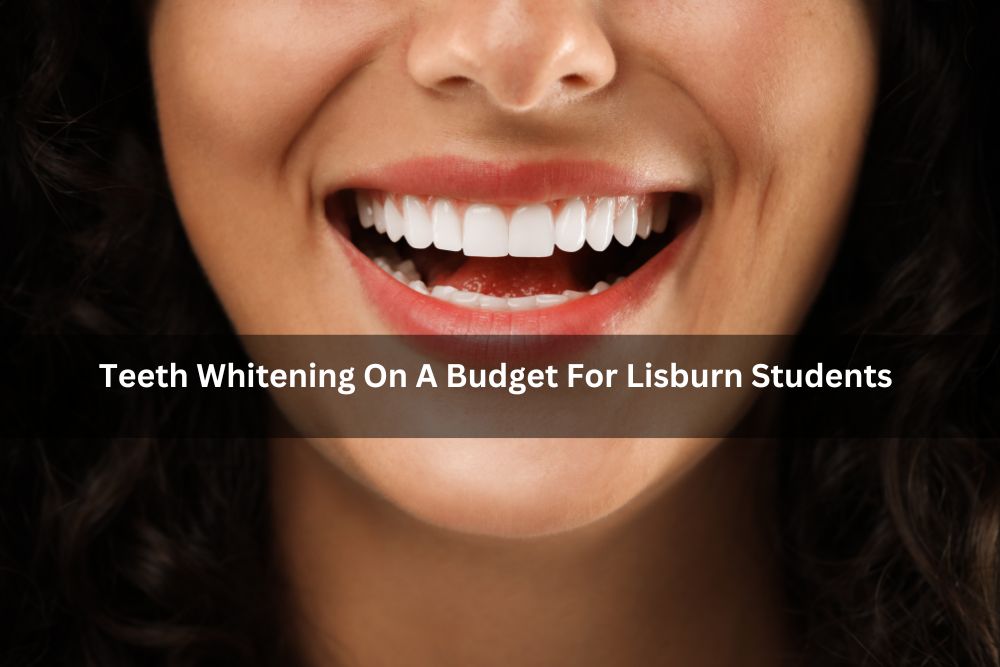 Teeth Whitening On A Budget For Lisburn Students