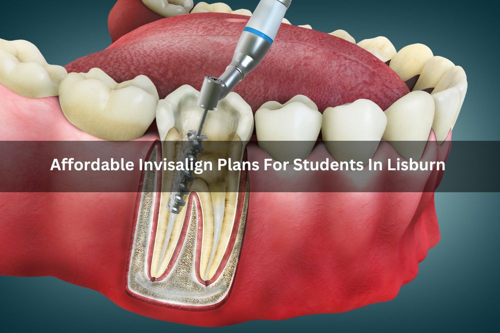 Affordable Invisalign Plans For Students In Lisburn