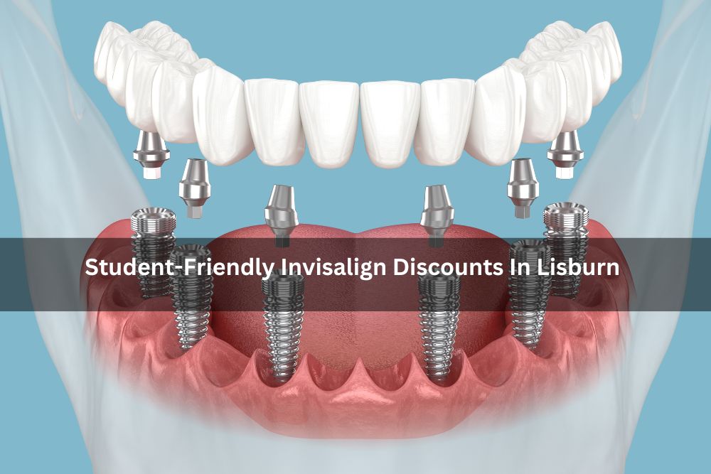 Student-Friendly Invisalign Discounts In Lisburn